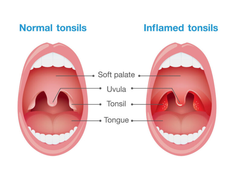 목의 구조를 나타낸 그림
